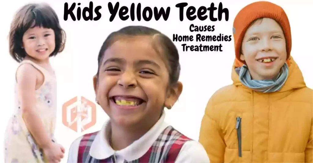 Kids Yellow Teeth, causes, home remedies and treatment