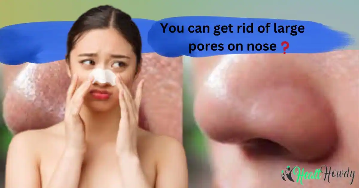 How To Get Rid Of Large Pores On Nose