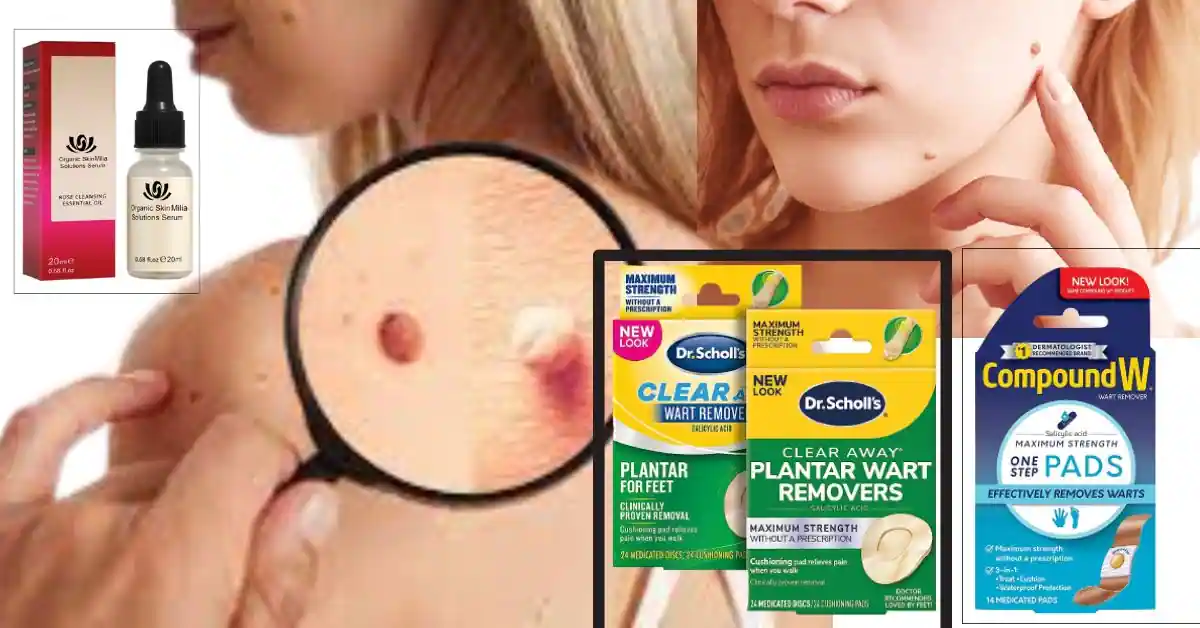 Effective and Best Skin Tag Remover