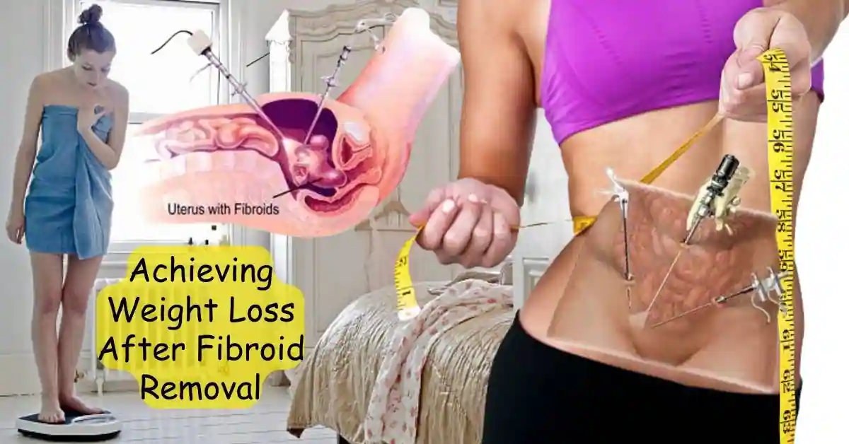 weight loss after fibroid removal