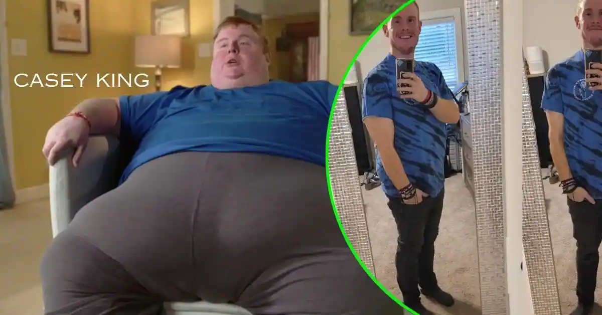 Casey King Weight Loss Transformation From 845 Lbs To 245 Lbs